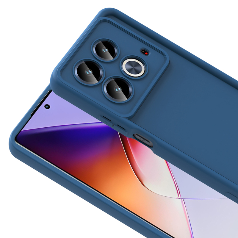 İnfinix Note 40 Pro Kılıf Kamera Korumalı Zore Ananas Kapak - 13