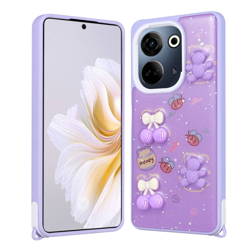 Tecno Camon 20 Case Shining Glitter Relief Figured Zore Cevze Cover - 5