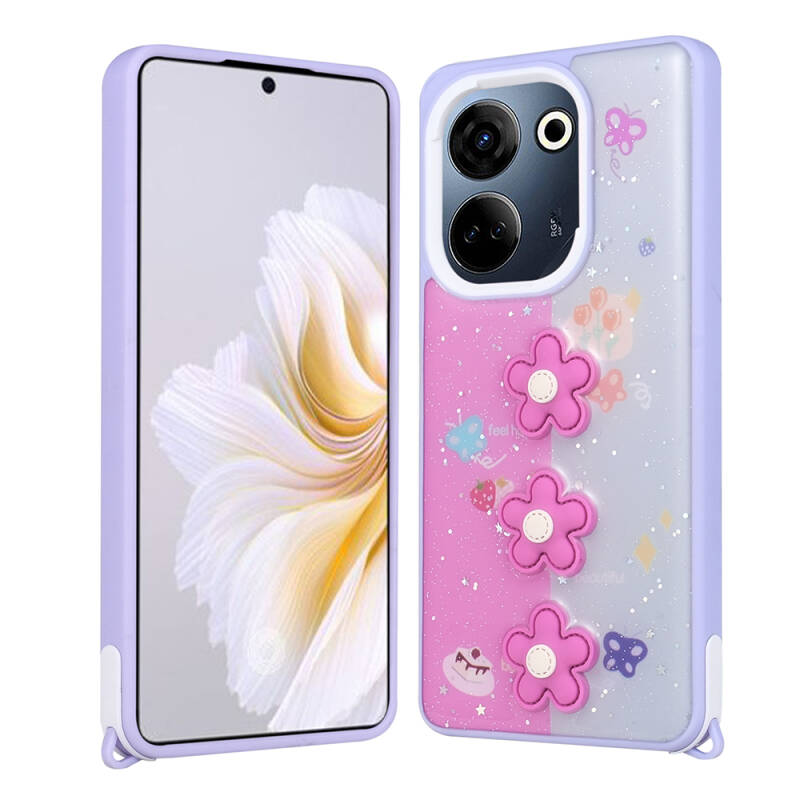 Tecno Camon 20 Kılıf Parlayan Simli Kabartma Figürlü Zore Cevze Kapak - 4