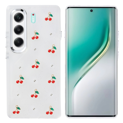 Tecno Camon 40 4G Case Airbag Design Glittery Transparent Zore Kutup Cover - 2