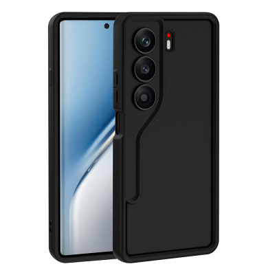 Tecno Camon 40 4G Case Camera Protection Zore Pineapple Design Cover - 5