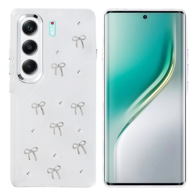 Tecno Camon 40 4G Kılıf Airbag Tasarımlı Simli Şeffaf Zore Kutup Kapak - 3