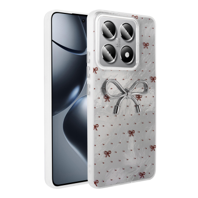 Xiaomi 14T Pro Case Camera Protection Figured Zore Ponti Silicone Cover - 2