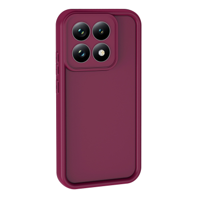 Xiaomi 15T Case with Camera Protection Zore Ananas Cover - 6