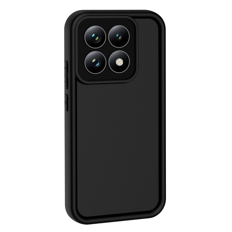 Xiaomi 15T Case with Camera Protection Zore Ananas Cover - 7