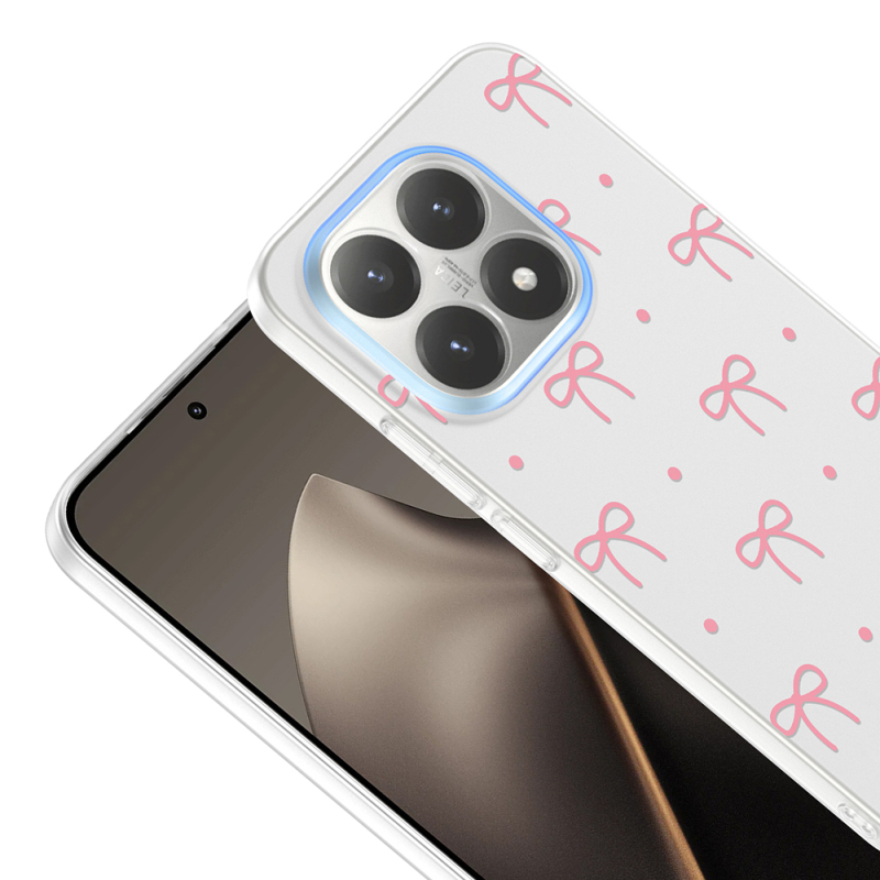 Xiaomi 15T Case with Camera Protector, Patterned Zore Clip Cover - 9