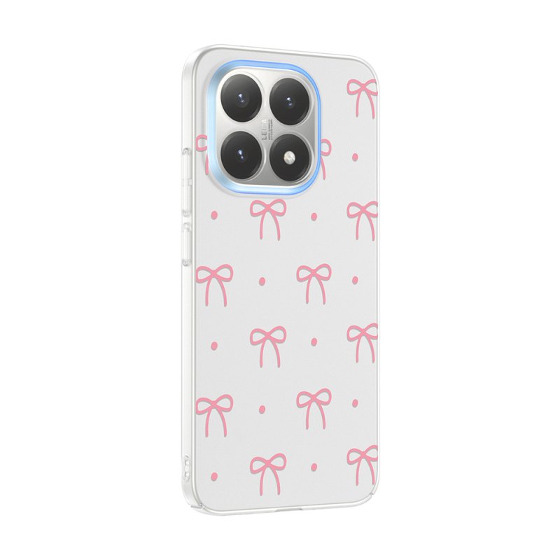 Xiaomi 15T Case with Camera Protector, Patterned Zore Clip Cover - 5