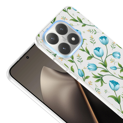 Xiaomi 15T Case with Camera Protector, Patterned Zore Clip Cover - 10