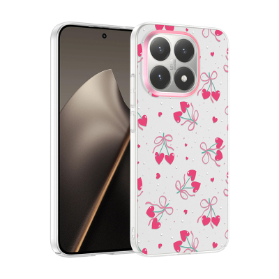 Xiaomi 15T Case with Camera Protector, Patterned Zore Clip Cover - 3