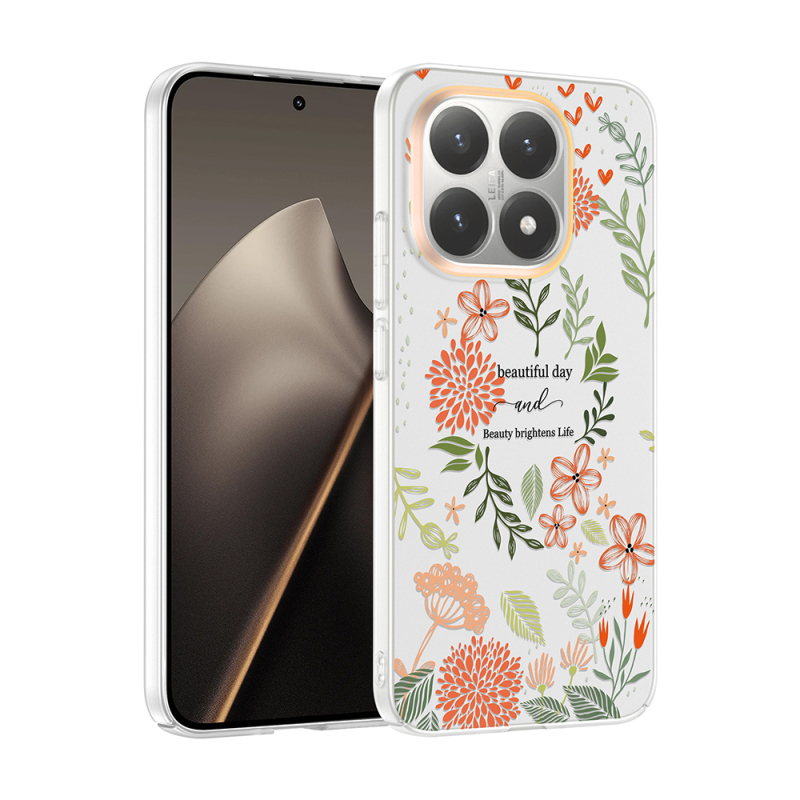 Xiaomi 15T Case with Camera Protector, Patterned Zore Clip Cover - 4