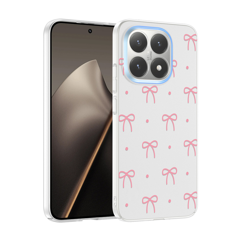 Xiaomi 15T Kılıf Kamera Korumalı Desenli Zore Klip Kapak - 1