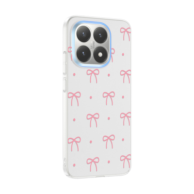 Xiaomi 15T Kılıf Kamera Korumalı Desenli Zore Klip Kapak - 5