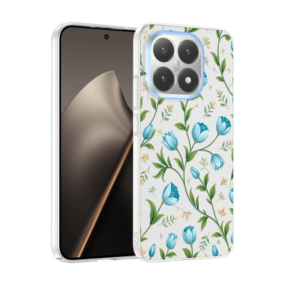 Xiaomi 15T Kılıf Kamera Korumalı Desenli Zore Klip Kapak - 2