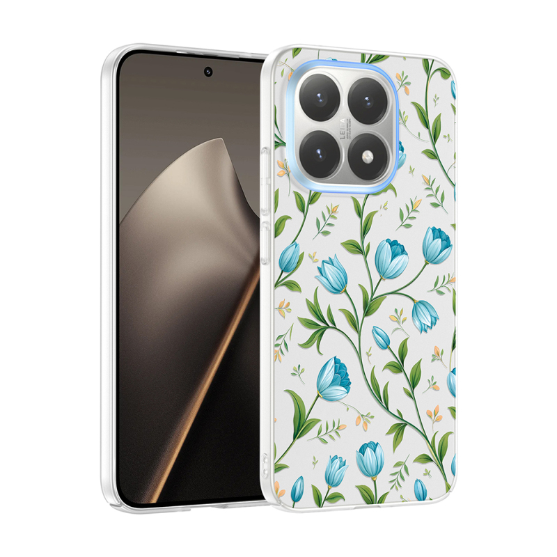 Xiaomi 15T Kılıf Kamera Korumalı Desenli Zore Klip Kapak - 2
