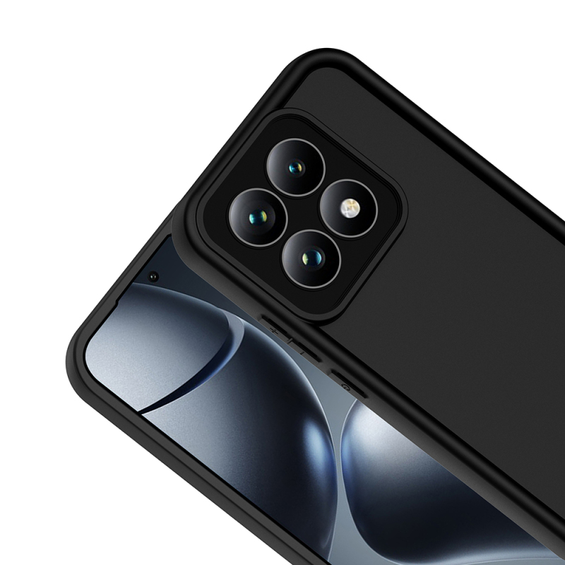 Xiaomi 15T Kılıf Kamera Korumalı Zore Ananas Kapak - 11