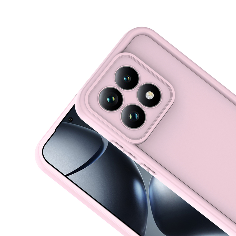 Xiaomi 15T Kılıf Kamera Korumalı Zore Ananas Kapak - 12