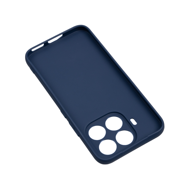 Xiaomi 15T Pro Case Zore Biye Silicone - 11