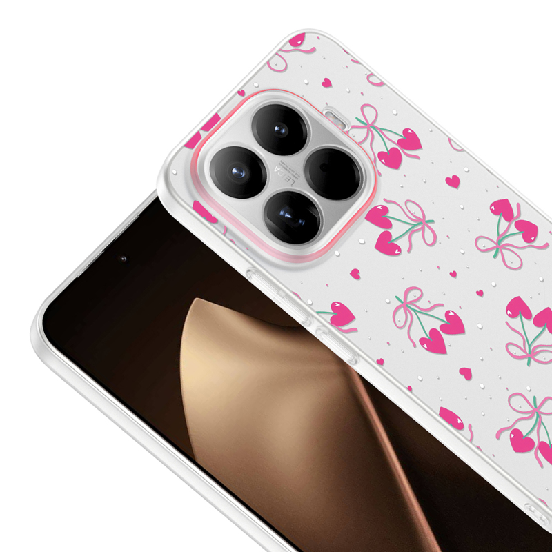Xiaomi 15T Pro Kılıf Kamera Korumalı Desenli Zore Klip Kapak - 9
