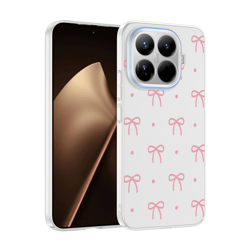 Xiaomi 15T Pro Kılıf Kamera Korumalı Desenli Zore Klip Kapak - 3