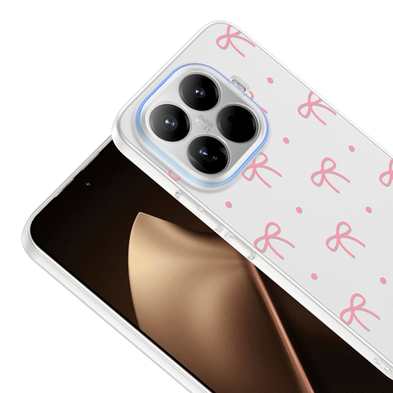 Xiaomi 15T Pro Kılıf Kamera Korumalı Desenli Zore Klip Kapak - 11