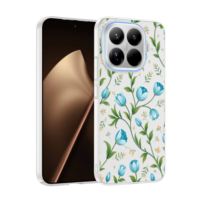 Xiaomi 15T Pro Kılıf Kamera Korumalı Desenli Zore Klip Kapak - 4