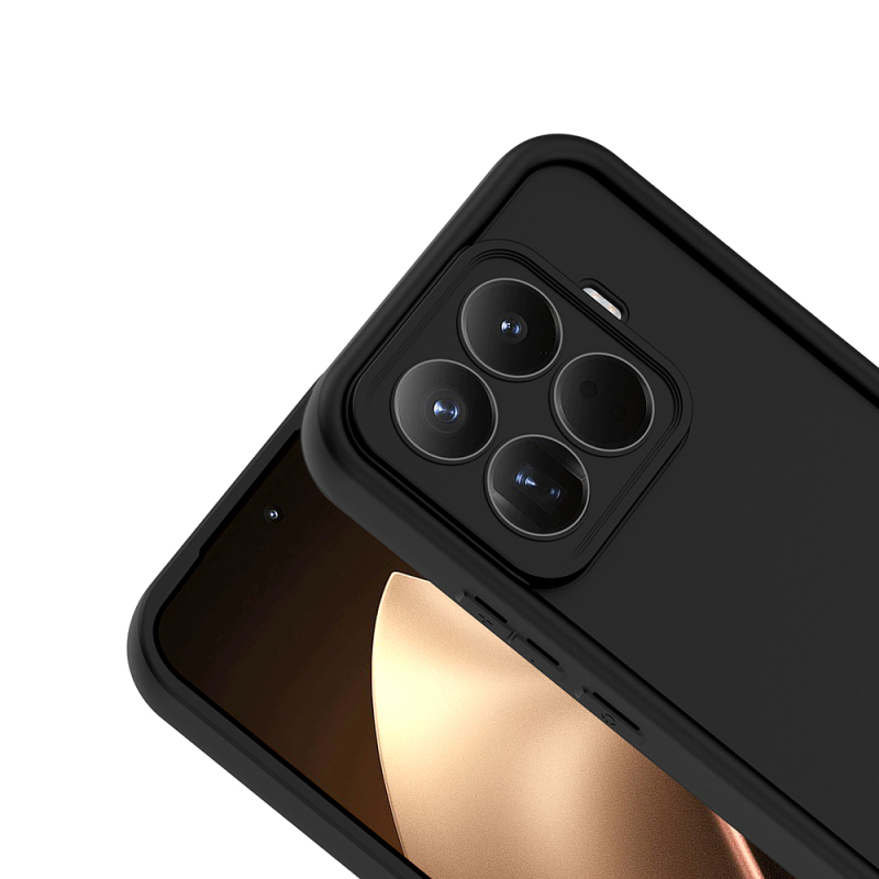 Xiaomi 15T Pro Kılıf Kamera Korumalı Zore Ananas Kapak - 11