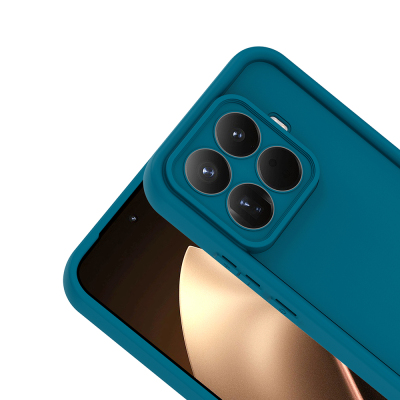 Xiaomi 15T Pro Kılıf Kamera Korumalı Zore Ananas Kapak - 12