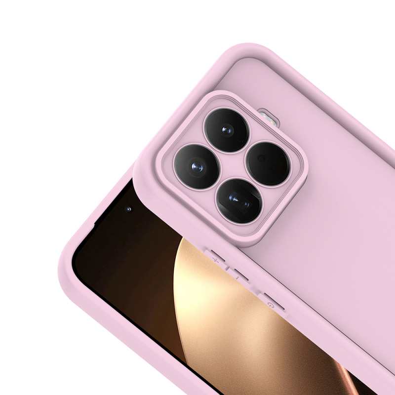 Xiaomi 15T Pro Kılıf Kamera Korumalı Zore Ananas Kapak - 13