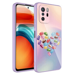 Xiaomi Redmi Note 10 Pro Case Camera Protected Patterned Hard Silicone Zore Epoxy Cover - 1