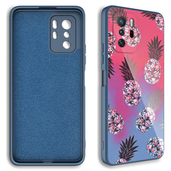 Xiaomi Redmi Note 10 Pro Case Camera Protected Patterned Hard Silicone Zore Epoxy Cover - 2