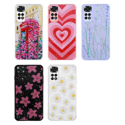 Xiaomi Redmi Note 11 Global Case Glittery Patterned Camera Protected Shiny Zore Popy Cover - 7