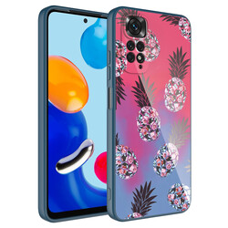 Xiaomi Redmi Note 11S Global Case Camera Protected Patterned Hard Silicone Zore Epoksi Cover - 6