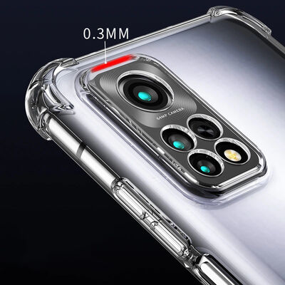 Xiaomi Redmi Note 11S Global Case Zore Camera Protector Nitro Anti Shock Silicon - 6