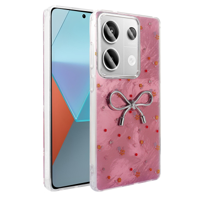 Xiaomi Redmi Note 13 Pro 4G Case Camera Protection Figured Zore Ponti Silicone Cover - 3