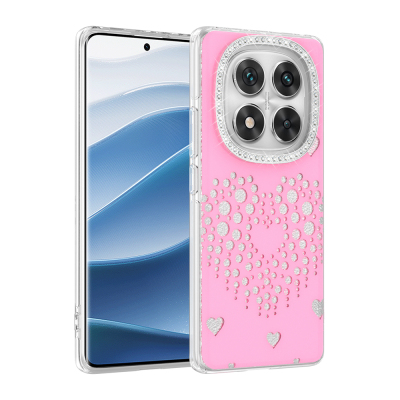 Xiaomi Redmi Note 14 Pro 4G Kılıf Damla Taşlı Zore Rivas Sert PC Kapak - 3