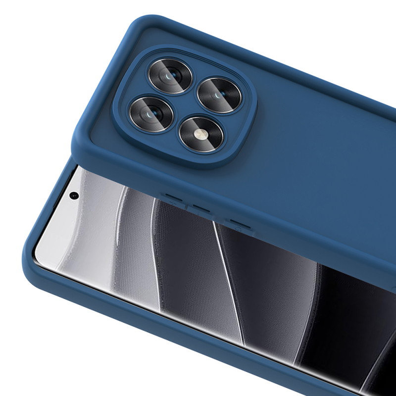 Xiaomi Redmi Note 14 Pro 5G Kılıf Kamera Korumalı Zore Ananas Kapak - 13