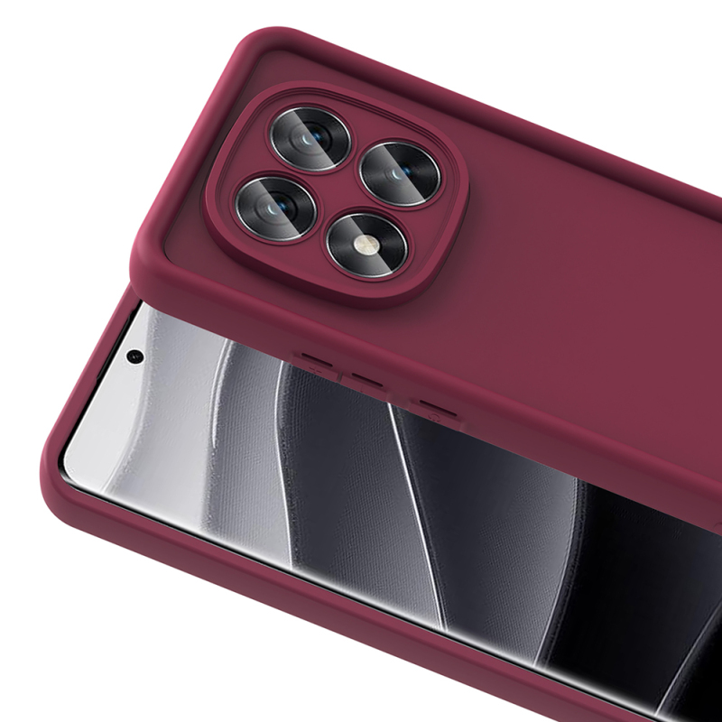 Xiaomi Redmi Note 14 Pro 5G Kılıf Kamera Korumalı Zore Ananas Kapak - 11