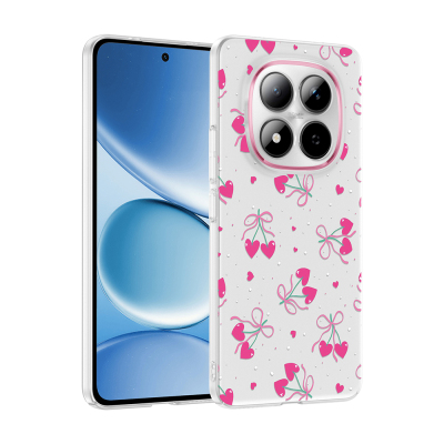 Xiaomi Redmi Note 15 Pro Kılıf Kamera Korumalı Desenli Zore Klip Kapak - 2