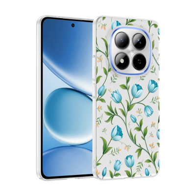 Xiaomi Redmi Note 15 Pro Plus Case with Camera Protector, Patterned Zore Clip Cover - 2