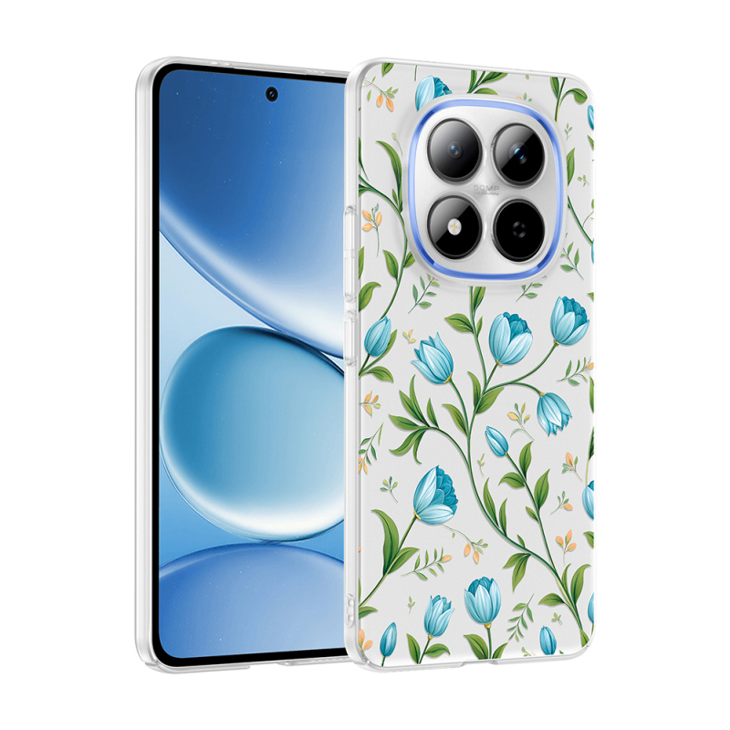 Xiaomi Redmi Note 15 Pro Plus Kılıf Kamera Korumalı Desenli Zore Klip Kapak - 2
