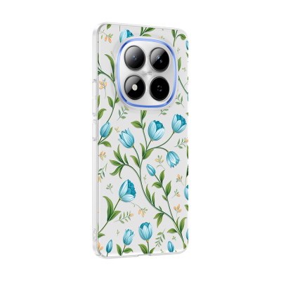 Xiaomi Redmi Note 15 Pro Plus Kılıf Kamera Korumalı Desenli Zore Klip Kapak - 6